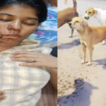 Stray Dog Attack in Kanpur Leaves BBA Student Critically Injured