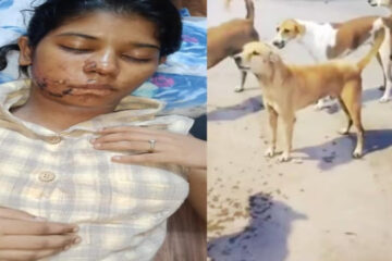 Stray Dog Attack in Kanpur Leaves BBA Student Critically Injured