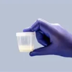 Quebec Judge Issues Landmark Injunction to Halt Serial Sperm Donations by Father and Son