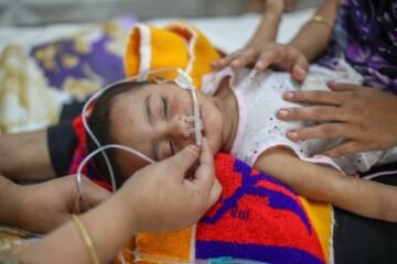 Bangladesh Measles Death Toll Crosses 630 as Outbreak Continues to Worsen