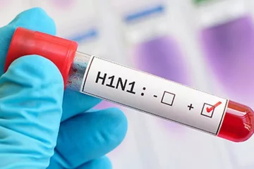 AAP Expresses Concern Over Rising Swine Flu Cases in Delhi, Urges Public Awareness Drive